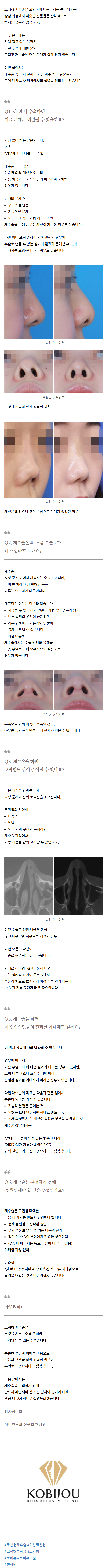 기능코수술 bjlnu
