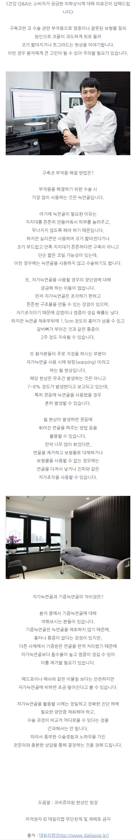 코성형재수술 douzu