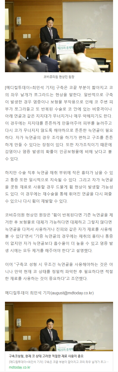 구순구개열성형외과 iwepx