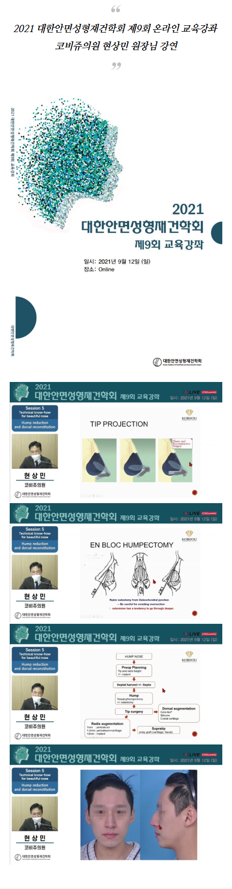 천공수술 fhlws