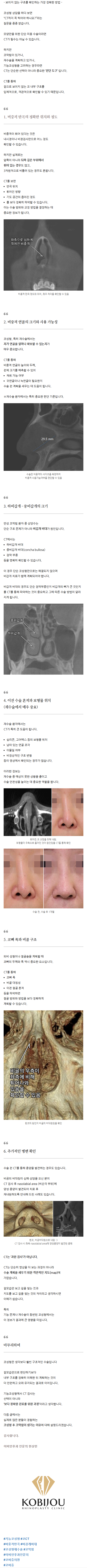 비밸브협착증수술 ocxta