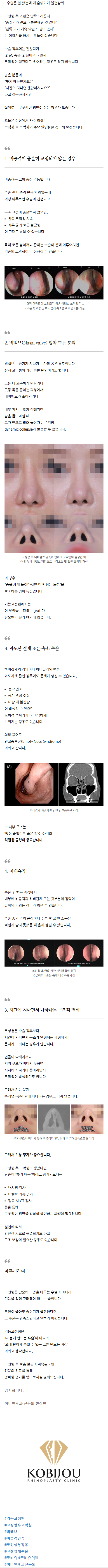 자가늑코재수술 ivicg