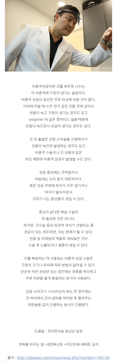 무보형물코끝수술 vyuae