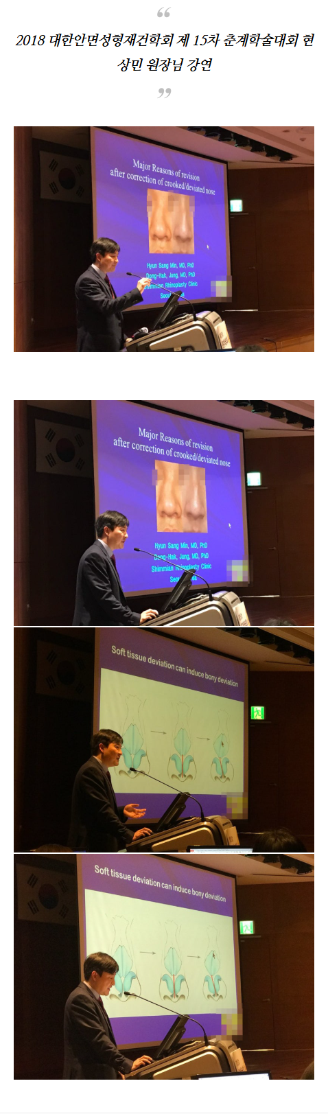비밸브협착증수술 zxgzm