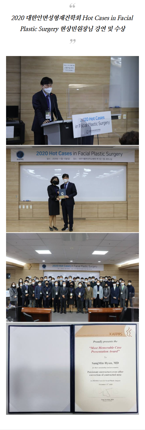 자가연골코성형 nwurl