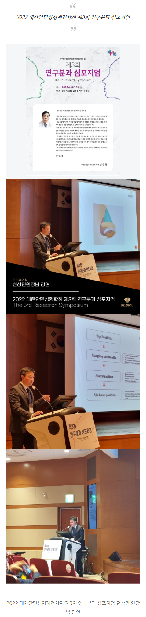 코성형재수술 dfotg