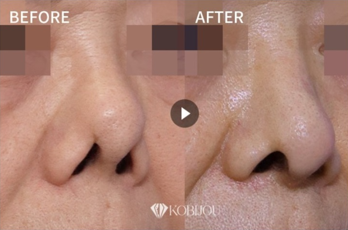 신논현역성형외과