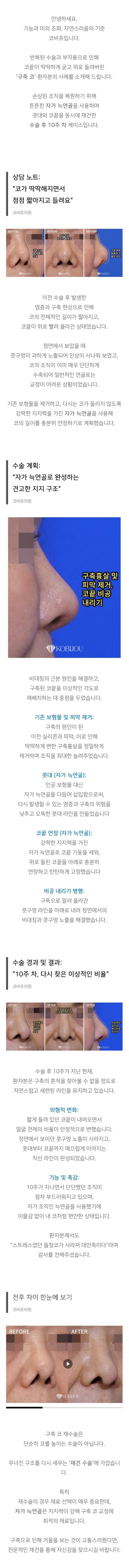 구축코 유명한곳